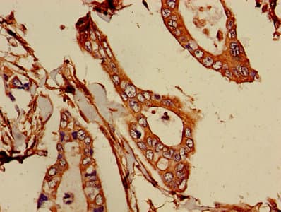 AICAR / ATIC Antibody