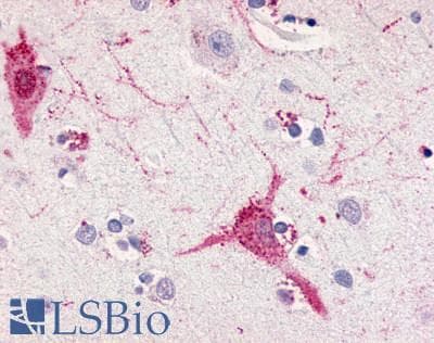 PathPlus™ Polyclonal Rabbit anti-Human FFAR1 / GPR40 Antibody (Cytoplasmic Domain, IHC, WB)
