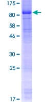 Human PRKAG3 / AMPK Gamma 3 Protein (Recombinant GST)