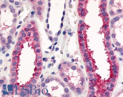 IHC-plus™ Polyclonal Rabbit anti-Human V1RL1 / VN1R1 Antibody (C-Terminus, IHC)