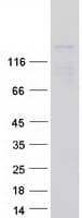 Human FMNL2 Protein (Recombinant Myc-DDK (Flag))