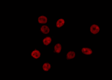 ROX / MNT Antibody