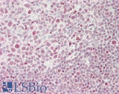 IHC-plus™ RNASEH2A Antibody (aa1-50)