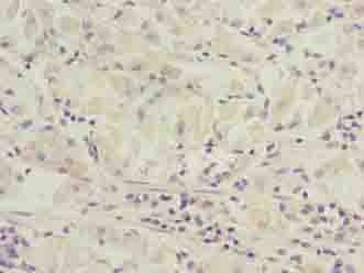 Polyclonal Rabbit anti-Human SLC52A1 / GPR172B / PAR2 Antibody (IHC)