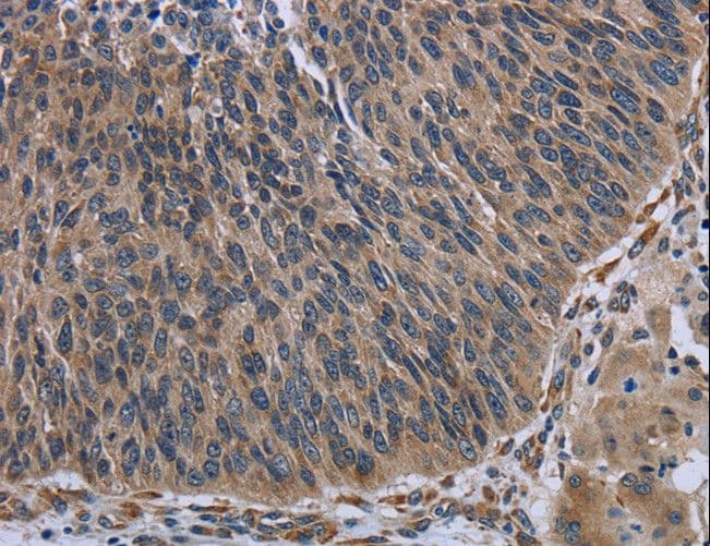 Polyclonal Rabbit anti-Human AVEN / PDCD12 Antibody (IHC, WB)