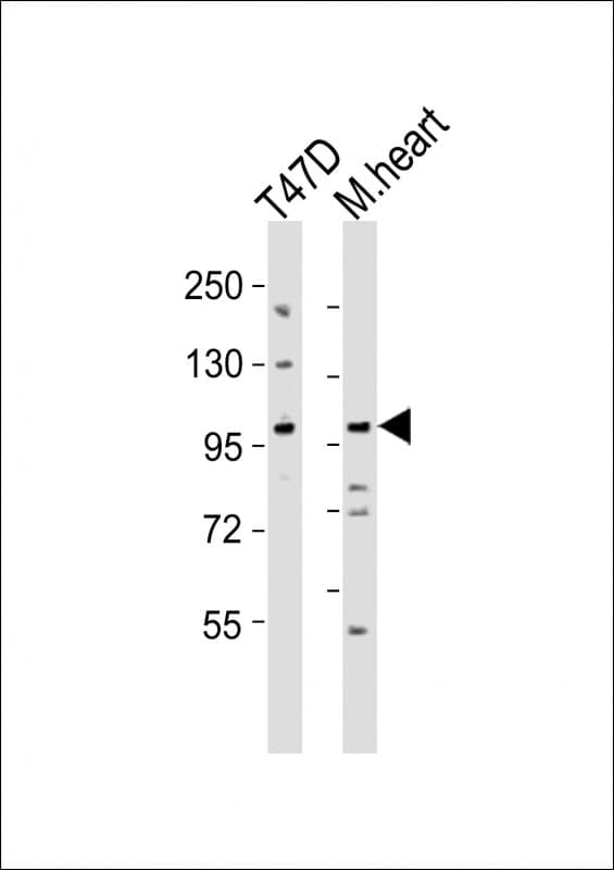 CLEC16A / KIAA0350 Antibody (aa773-805)