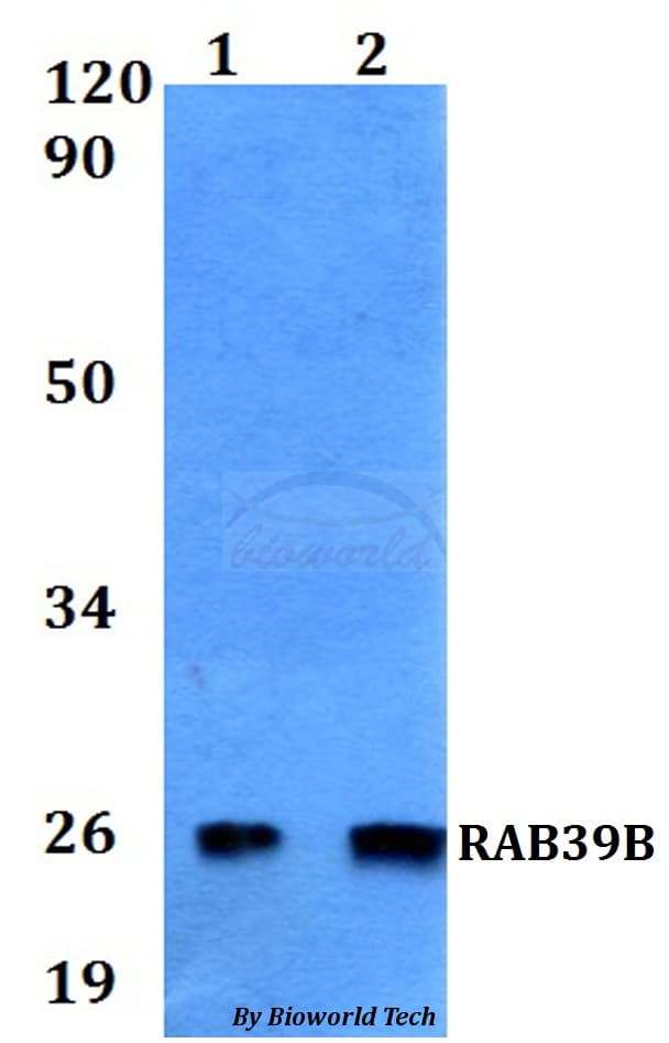 Polyclonal Rabbit anti-Human RAB39B Antibody (WB)