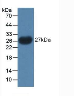 PTHLH / PTHRP Antibody (aa38-176)