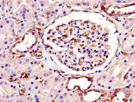 Polyclonal Rabbit anti-Human SWI5 / C9orf119 Antibody (IHC, WB)