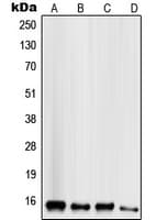 Polyclonal Rabbit anti-Human SCGB2A1 / Mammaglobin B Antibody (N-Terminus, IHC, IF, WB)