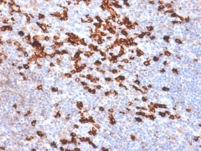 Recombinant Monoclonal Rabbit anti-Human Kappa Light Chain Antibody (clone IGKC/1999R, IHC)