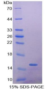 Mouse AHSP / EDRF Protein (Recombinant His-T7)