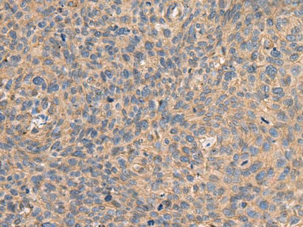 Polyclonal Rabbit anti-Human AHNAK Antibody (IHC)