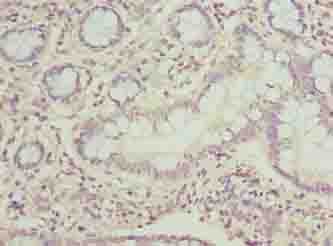 PPIL3 Antibody