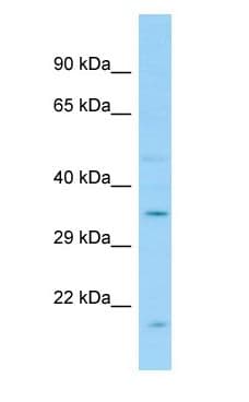 GPR12 Antibody (aa168-217)