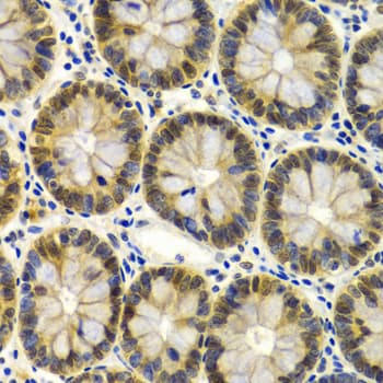 SMARCE1 / BAF57 Antibody
