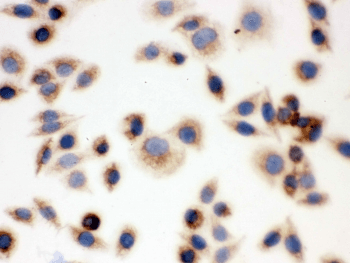 BAK1 / BAK Antibody