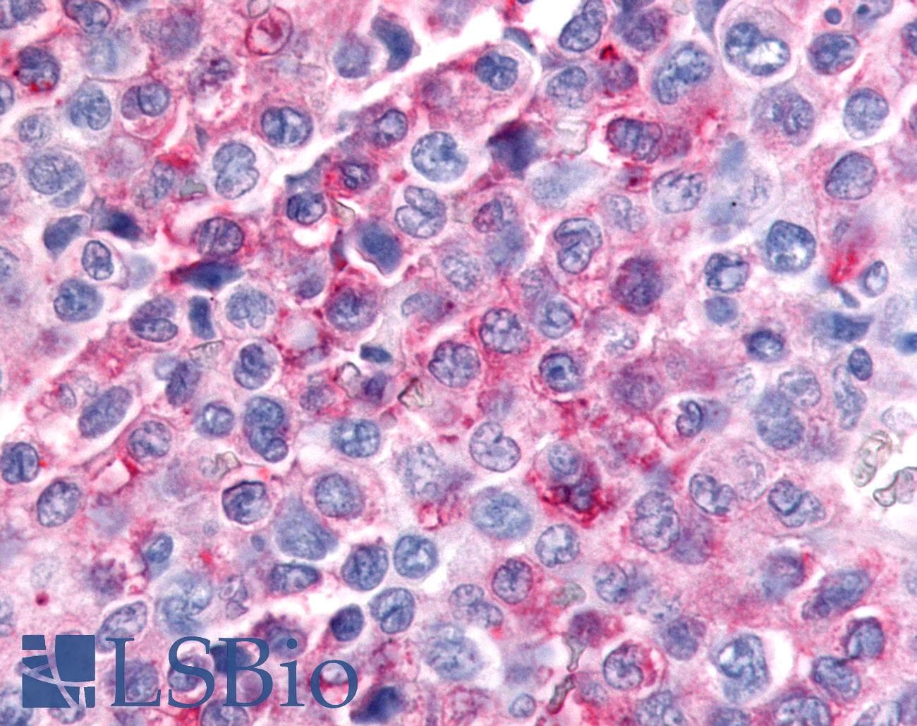 PathPlus™ Polyclonal Rabbit anti-Human MINK1 / MINK Antibody (Internal, IHC)