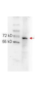 Monoclonal Mouse anti-Human RELA / NFKB p65 Antibody (clone 27F9.G4, C-Terminus, IHC, IF, WB)