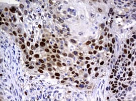 Monoclonal Mouse anti-Human PCNA Antibody (clone OTI1D11, IHC, WB)