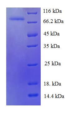 Human HSPA6 / HSP70B' Protein (Recombinant His)