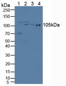 IREB2 / IRP2 Antibody (aa39-281)