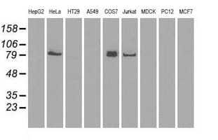 Monoclonal Mouse anti-Human BRAF / B-Raf Antibody (clone OTI4G6, IHC, WB)