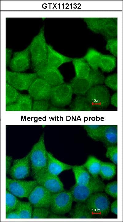 Polyclonal Rabbit anti-Human EXOC7 Antibody (aa74-335, WB)