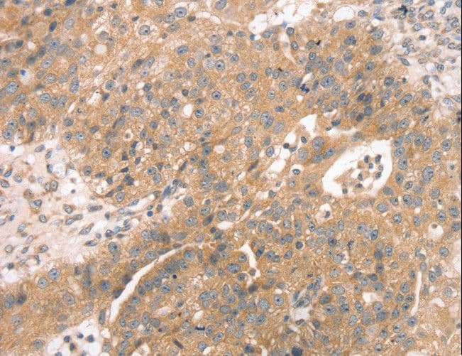 STX10 / Syntaxin 10 Antibody