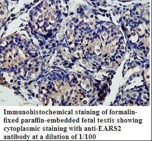 KIAA1970 / EARS2 Antibody (aa22-253)