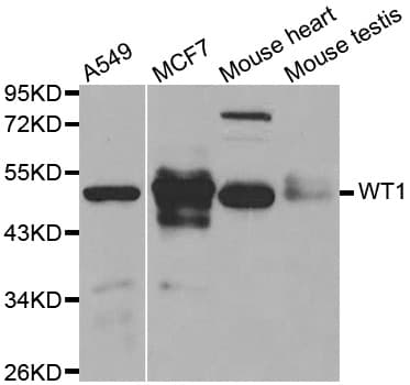 WT1 / Wilms Tumor 1 Antibody