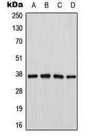 Polyclonal Rabbit anti-Human CTSH / Cathepsin H Antibody (Internal, IHC, WB)