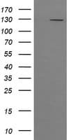 Monoclonal Mouse anti-Human PIK3CG / PI3K Gamma Antibody (clone OTI6C6, IHC, WB)