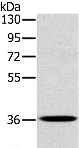 PDLIM1 Antibody