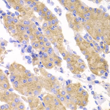 Polyclonal Rabbit anti-Human SMYD4 Antibody (IHC, IF, WB)