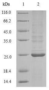 Avena sativa Endochitinase Protein (Recombinant 10His, N-terminus + Myc, C-terminus)