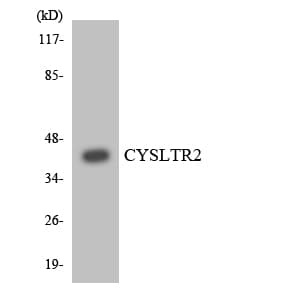 CYSLT2 / CYSLTR2 Antibody (aa275-324)