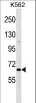 POU2F1 / OCT1 Antibody (aa1-30)