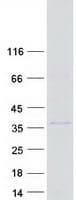 Human UNKL Protein (Recombinant Myc-DDK (Flag))