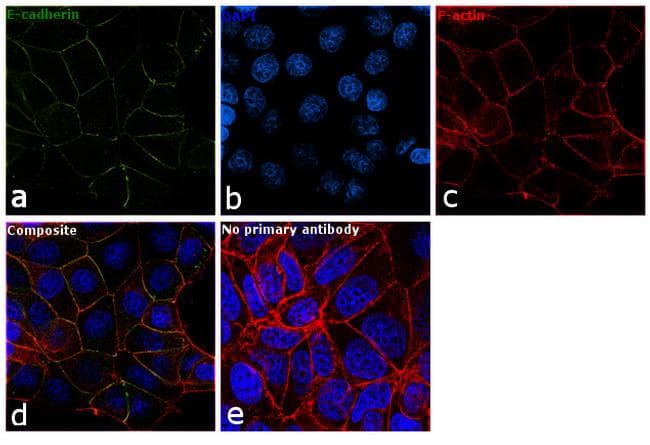 CDH1 / E Cadherin Antibody (clone 67A4)