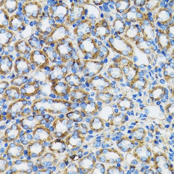 CTNNA1 / Catenin Alpha-1 Antibody