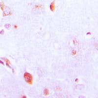 ARSA / Arylsulfatase A Antibody (Internal)
