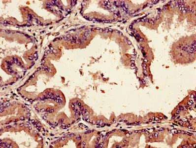 BMP2 Antibody