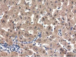 QPRT Antibody (clone OTI1C10, Carrier-free)