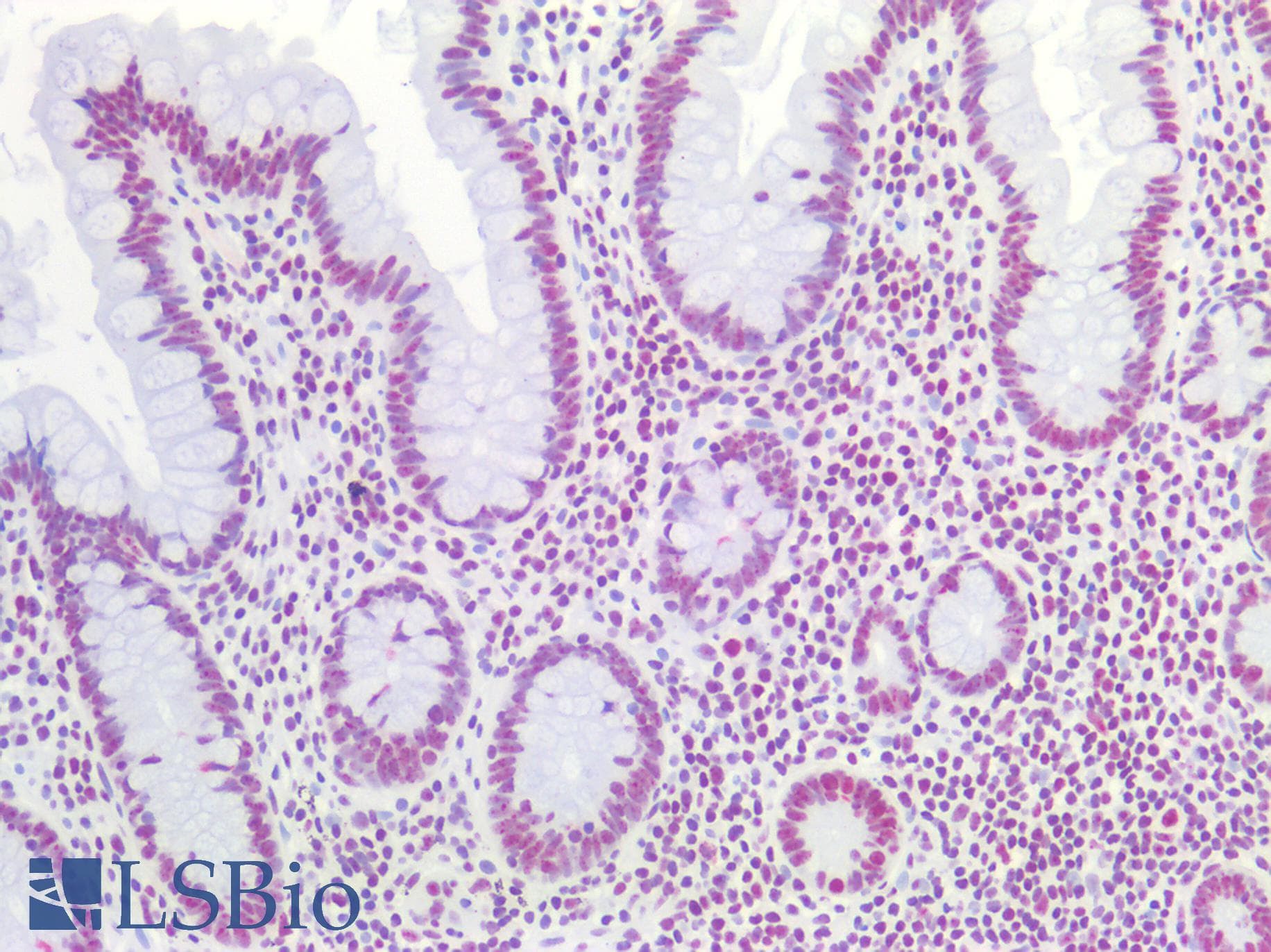 PathPlus™ SMN1 Antibody (aa50-100)