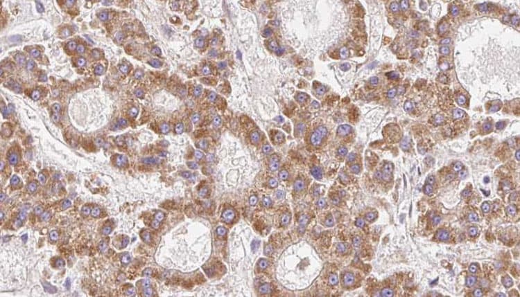 Polyclonal Rabbit anti-Human CLDN23 / Claudin 23 Antibody (aa215-244, IHC, WB)