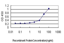 Monoclonal Mouse anti-Human TRIP / LRRFIP1 Antibody (clone 2D3, IF, WB)