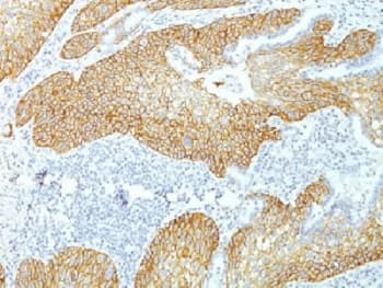DSG3 / Desmoglein 3 Antibody (clone DSG3/1535, Azide-free, BSA-free)