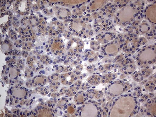 Monoclonal Mouse anti-Human SMPD1 / Acid Sphingomyelinase Antibody (clone OTI3H7, aa62-341, IHC, WB)