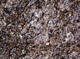 HSPD1 / HSP60 Antibody (clone OTI3G1)